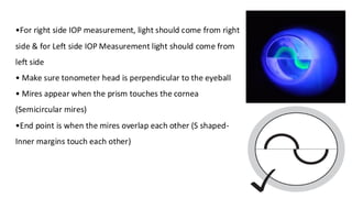 •For right side IOP measurement, light should come from right
side & for Left side IOP Measurement light should come from
left side
• Make sure tonometer head is perpendicular to the eyeball
• Mires appear when the prism touches the cornea
(Semicircular mires)
•End point is when the mires overlap each other (S shaped-
Inner margins touch each other)
 