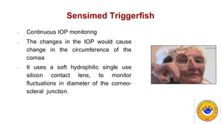 Sensimed Triggerfish
- Continuous IOP monitoring
- The changes in the IOP would cause
change in the circumference of the
cornea
- It uses a soft hydrophilic single use
silicon contact lens, to monitor
fluctuations in diameter of the corneo-
scleral junction.
 