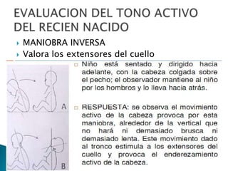 


MANIOBRA INVERSA
Valora los extensores del cuello

 