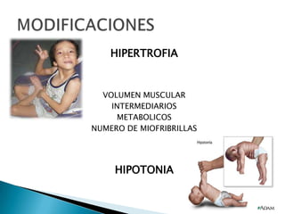 HIPERTROFIA

VOLUMEN MUSCULAR
INTERMEDIARIOS
METABOLICOS
NUMERO DE MIOFRIBRILLAS

HIPOTONIA

 