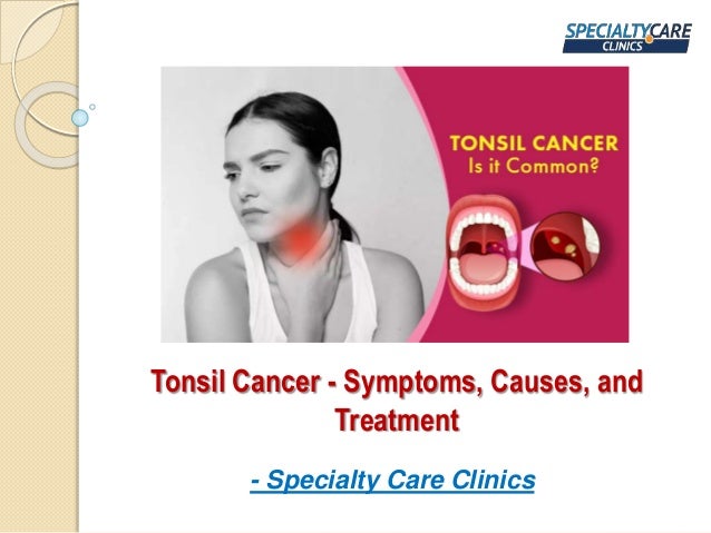 Tonsil Cancer - Symptoms, Causes, and
Treatment
- Specialty Care Clinics
 