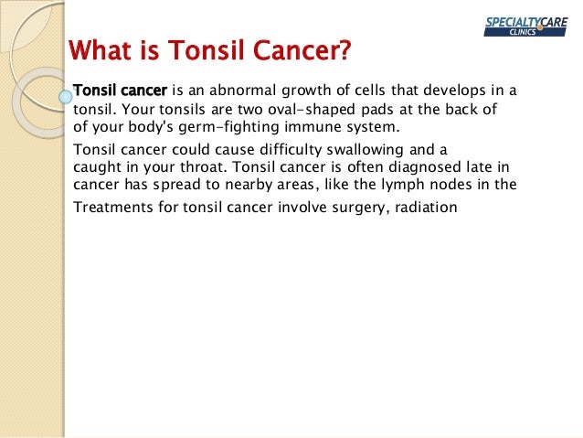 Tonsil Cancer Symptoms Causes And Treatment
