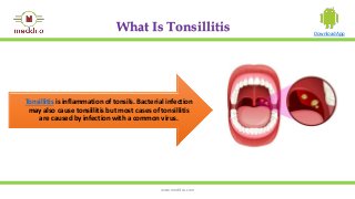Tonsillitis types,Causes,Symptoms,Diagnosis,Prevention and treatment