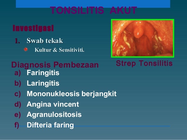 Ubat Sakit Tonsil Bengkak - Perubatan m