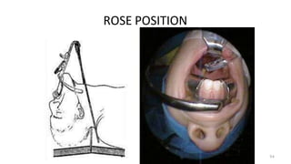 ROSE POSITION
54
 