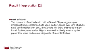 EBV connection to adenotonsillar hypetrophy | PPTX