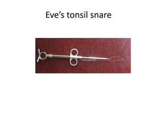 Eve’s tonsil snare
 