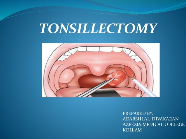 Tonsillectomy