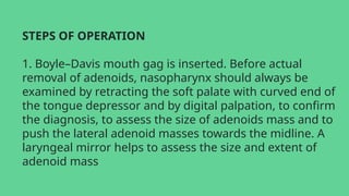 STEPS OF OPERATION
1. Boyle–Davis mouth gag is inserted. Before actual
removal of adenoids, nasopharynx should always be
examined by retracting the soft palate with curved end of
the tongue depressor and by digital palpation, to confirm
the diagnosis, to assess the size of adenoids mass and to
push the lateral adenoid masses towards the midline. A
laryngeal mirror helps to assess the size and extent of
adenoid mass
 