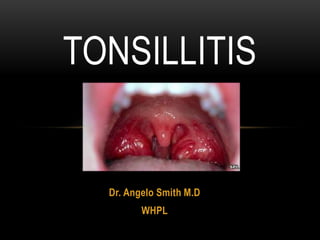 TONSILLITIS 
Dr. Angelo Smith M.D 
WHPL 
 