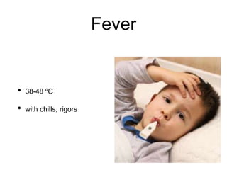 Fever
• 38-48 ºC
• with chills, rigors
 
