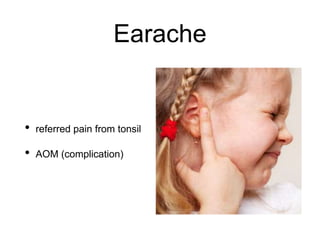 Earache
• referred pain from tonsil
• AOM (complication)
 