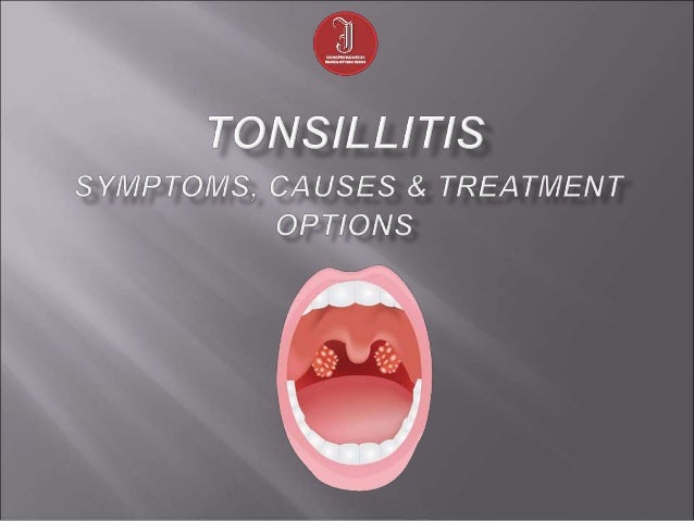 Tonsillitis Symptoms Causes And Treatment Options