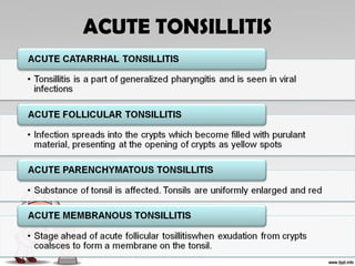 ACUTE TONSILLITIS
 