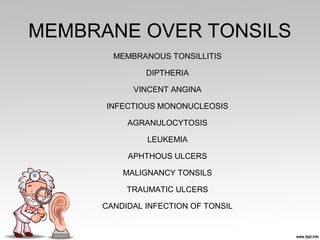 MEMBRANE OVER TONSILS
MEMBRANOUS TONSILLITIS
DIPTHERIA
VINCENT ANGINA
INFECTIOUS MONONUCLEOSIS
AGRANULOCYTOSIS
LEUKEMIA
APHTHOUS ULCERS
MALIGNANCY TONSILS
TRAUMATIC ULCERS
CANDIDAL INFECTION OF TONSIL
 