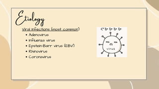 Etiology
Viral Infections (most common)
Adenovirus
Influenza virus
Epstein-Barr virus (EBV)
Rhinovirus
Coronavirus
 