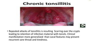 • Repeated attacks of tonsillitis is resulting Scarring over the crypts
leading to retention of infection material with tonsils. Clinical
manifestation more generalized than Local features may present
recurrent sore throat and tiredness.
 