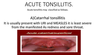 ACUTE TONSILLITIS.
Acute tonsillitis may classified as follows.
A)Catarrhal tonsillitis
It is usually present with URI and MEASLES it is least severe
from the manifested As redness and sore throat.
 