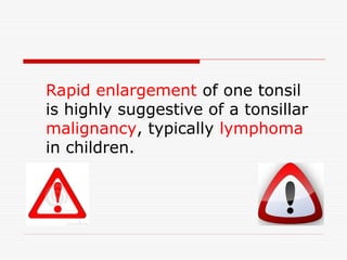 Rapid enlargement of one tonsil
is highly suggestive of a tonsillar
malignancy, typically lymphoma
in children.
 
