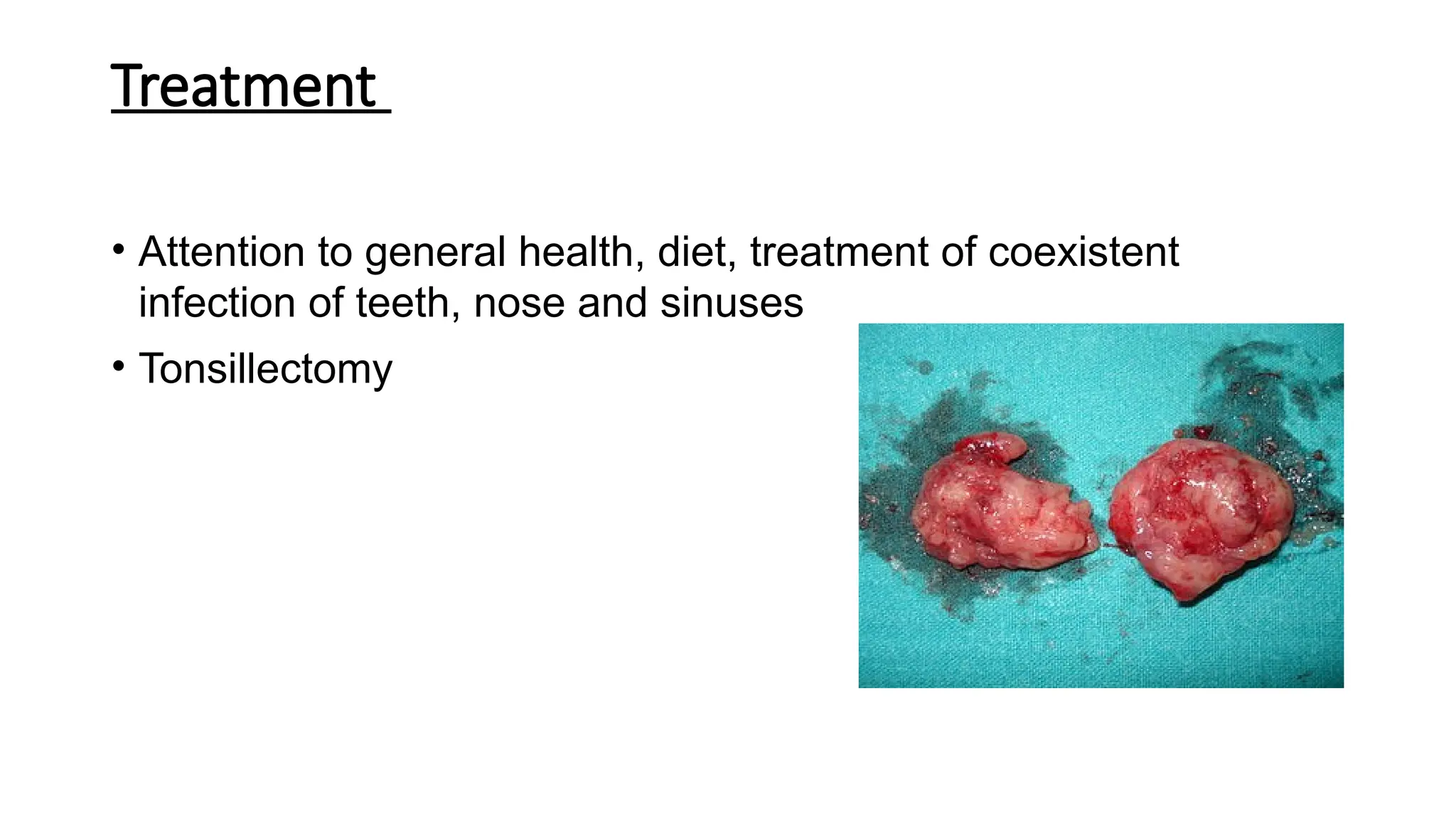 Treatment
• Attention to general health, diet, treatment of coexistent
infection of teeth, nose and sinuses
• Tonsillectomy
 
