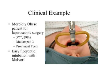Morbid Examples Tonsil Mouth Gag Fiberoptic | PPT