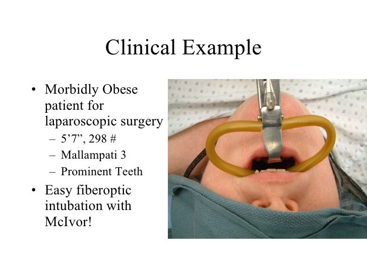 Tonsil Mouth Gag Fiberoptic