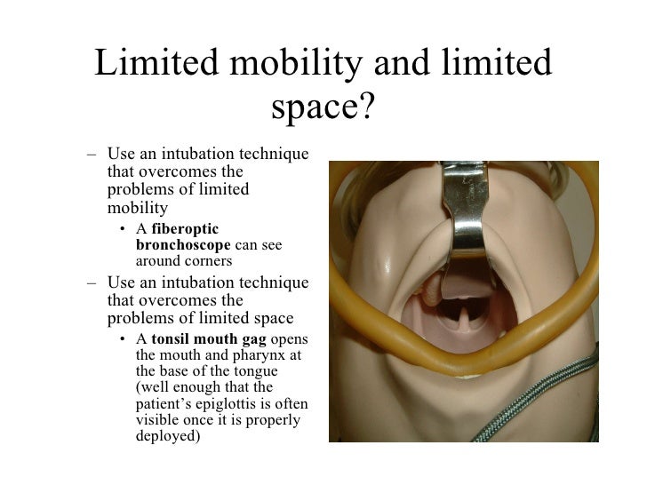 Tonsil Mouth Gag Fiberoptic