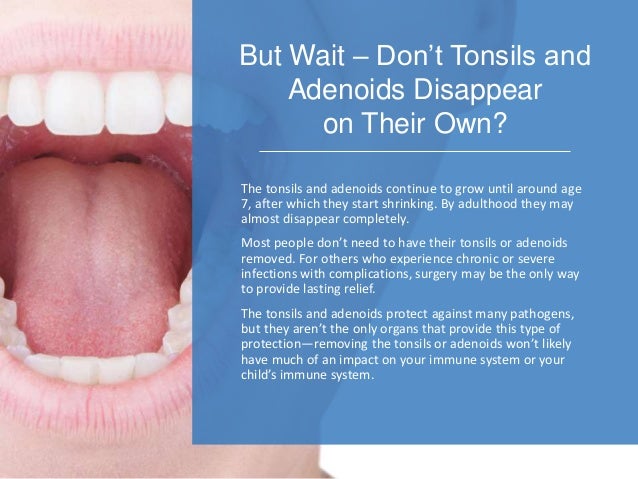 Tonsils And Adenoids Functions Common Problems And Treatments