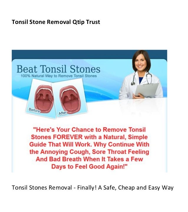 Tonsil stone removal qtip trust