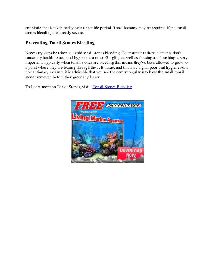 Tonsil stones bleeding