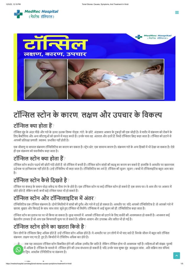 Tonsil Stones_ Causes, Symptoms, And Treatment In Hindi.pdf
