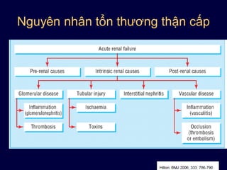 Nguyên nhân tổn thương thận cấp
 