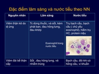Đặc điểm lâm sàng và nước tiểu theo NN
Nguyên nhân Lâm sàng Nước tiểu
Viêm thận kẽ do
dị ứng
Tc dùng thuốc, và sốt, kèm
phát ban, đau hông lưng,
đau khớp
Trụ bạch cầu, bạch
cầu ( chủ yếu
eosinophil), hiếm trụ
HC, protein niệu
Viêm đài bể thận
cấp
Sốt , đau hông lưng, vẻ
nhiễm trùng
Bạch cầu, đôi khi có
hồng cầu, vi khuẩn
Eosinophil trong
nước tiểu
 