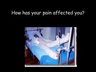 How has your pain affected you? 