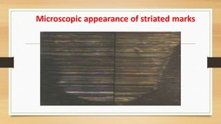 Forensic Importance of Tool marks. pptx. | PPTX