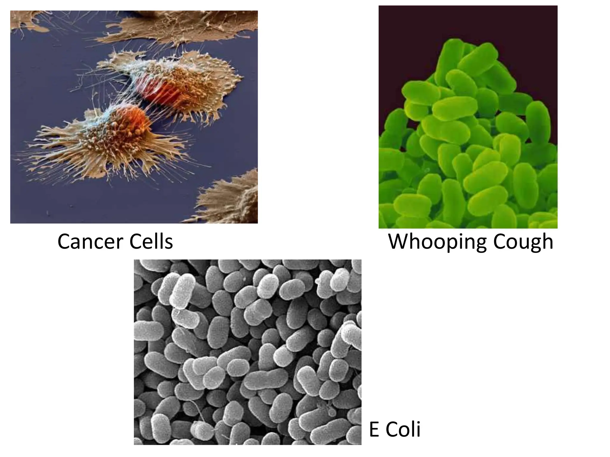 Cancer Cells Whooping Cough
E Coli
 