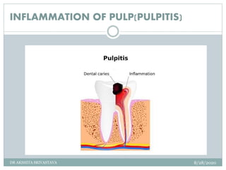 TOOTHACHE ( TOOTH PAIN ) | PPTX