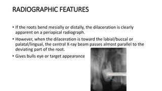 tooth anomalies in dental practise .pptx