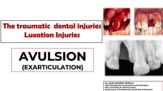 The traumatic dental injuries
Luxation Injuries
AVULSION
(EXARTICULATION)
Dr. Hadil Abdallah Altilbani
BDS Santiago de Compostela University Spain.
MSc. University of Valencia Spain.
Department of Endodontics University of Palestine
 