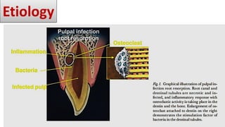 Tooth Avulsion Project tooth avulsion.pdf