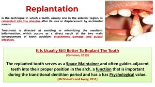 Tooth Avulsion Project tooth avulsion.pdf