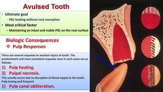 Tooth Avulsion Project tooth avulsion.pdf