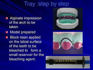 Tray :step by step
Alginate impression
of the arch to be
taken.
Model prepared
Block resin applied
on the labial surface
of the teeth to be
bleached to form a
small reservoir for the
bleaching agent.
 