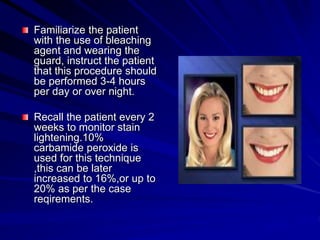 Familiarize the patient
with the use of bleaching
agent and wearing the
guard, instruct the patient
that this procedure should
be performed 3-4 hours
per day or over night.
Recall the patient every 2
weeks to monitor stain
lightening.10%
carbamide peroxide is
used for this technique
,this can be later
increased to 16%,or up to
20% as per the case
reqirements.
 