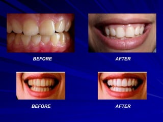 AFTER
AFTER
BEFORE
BEFORE
 