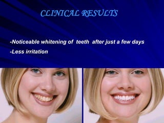 CLINICAL RESULTS
-Noticeable whitening of teeth after just a few days
-Less irritation
 