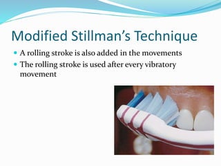 Modified Stillman’s Technique
 A rolling stroke is also added in the movements
 The rolling stroke is used after every vibratory
movement
 