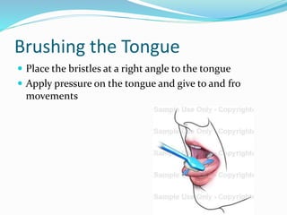 Brushing the Tongue
 Place the bristles at a right angle to the tongue
 Apply pressure on the tongue and give to and fro
movements
 