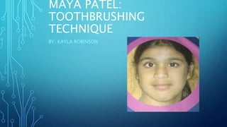 MAYA PATEL:
TOOTHBRUSHING
TECHNIQUE
BY: KAYLA ROBINSON
 