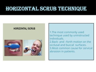 HORIZONTAL SCRUB TECHNIQUE
1.The most commonly used
technique used by uninstructed
individuals.
2.Back -and –forth motion on the
occlusal and buccal surfaces.
3.Most common cause for cervical
abrasion in patients.
 
